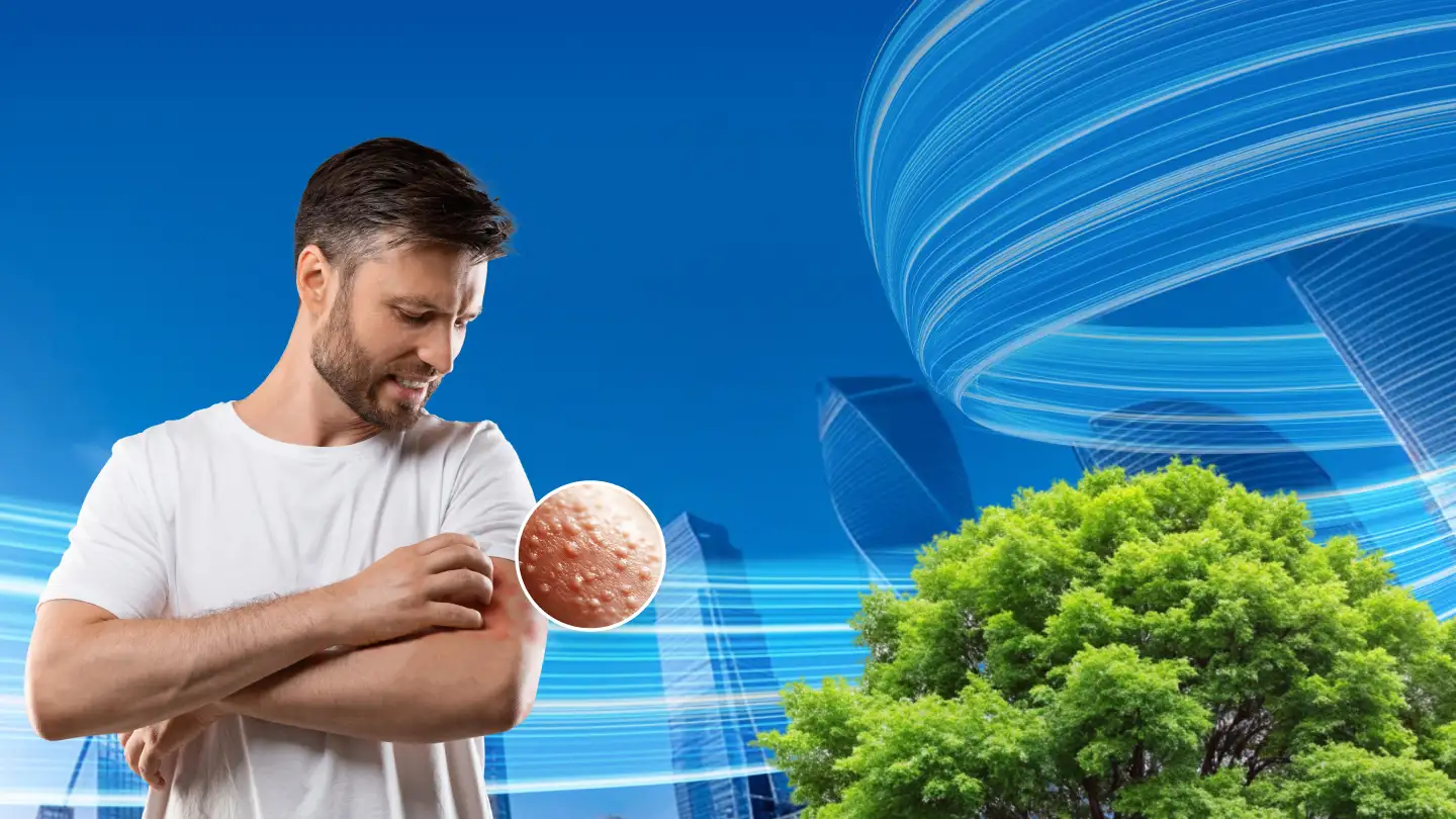 Холинергическая крапивница