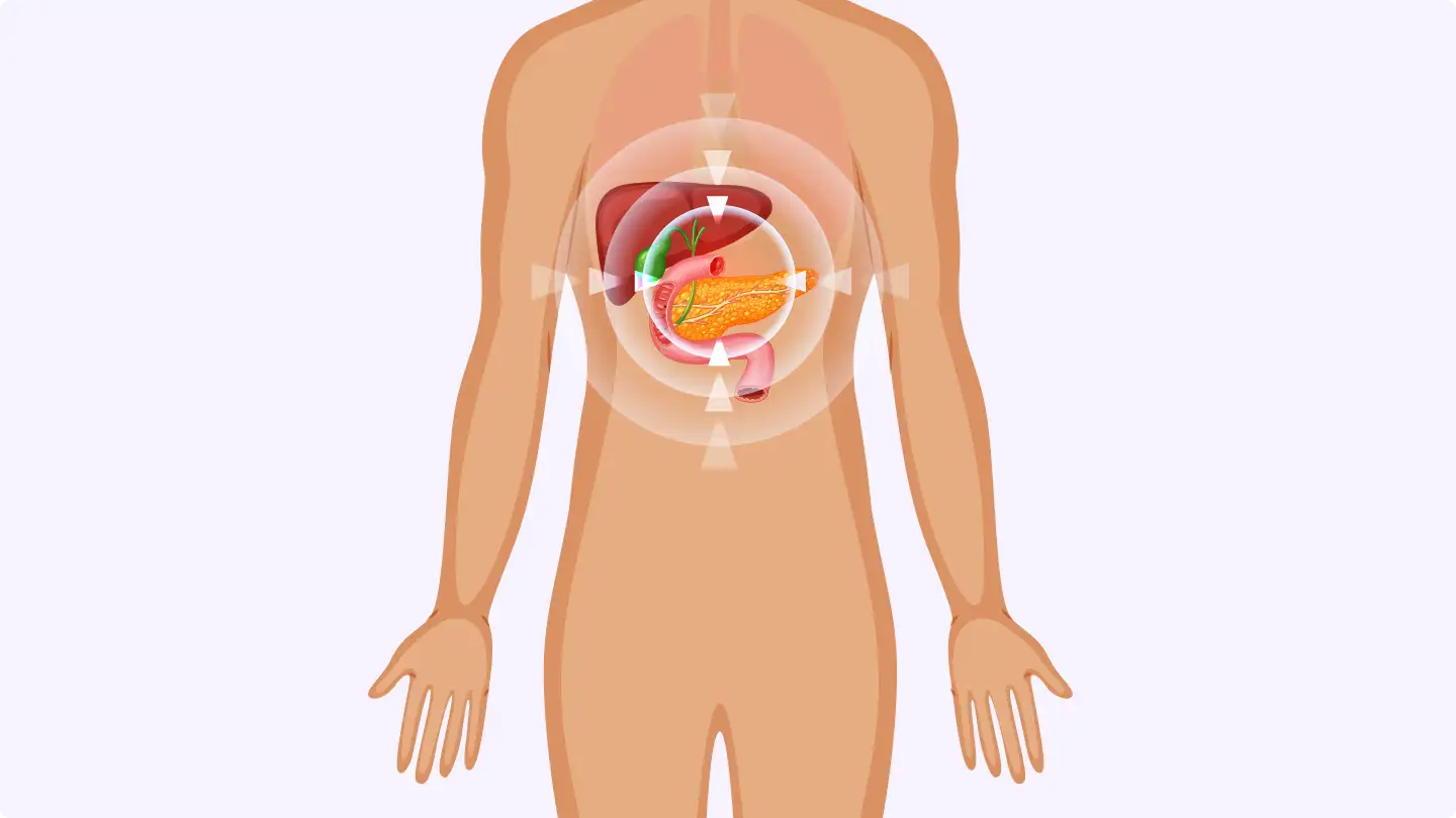 лечение острого панкреатита средней и тяжелой степени