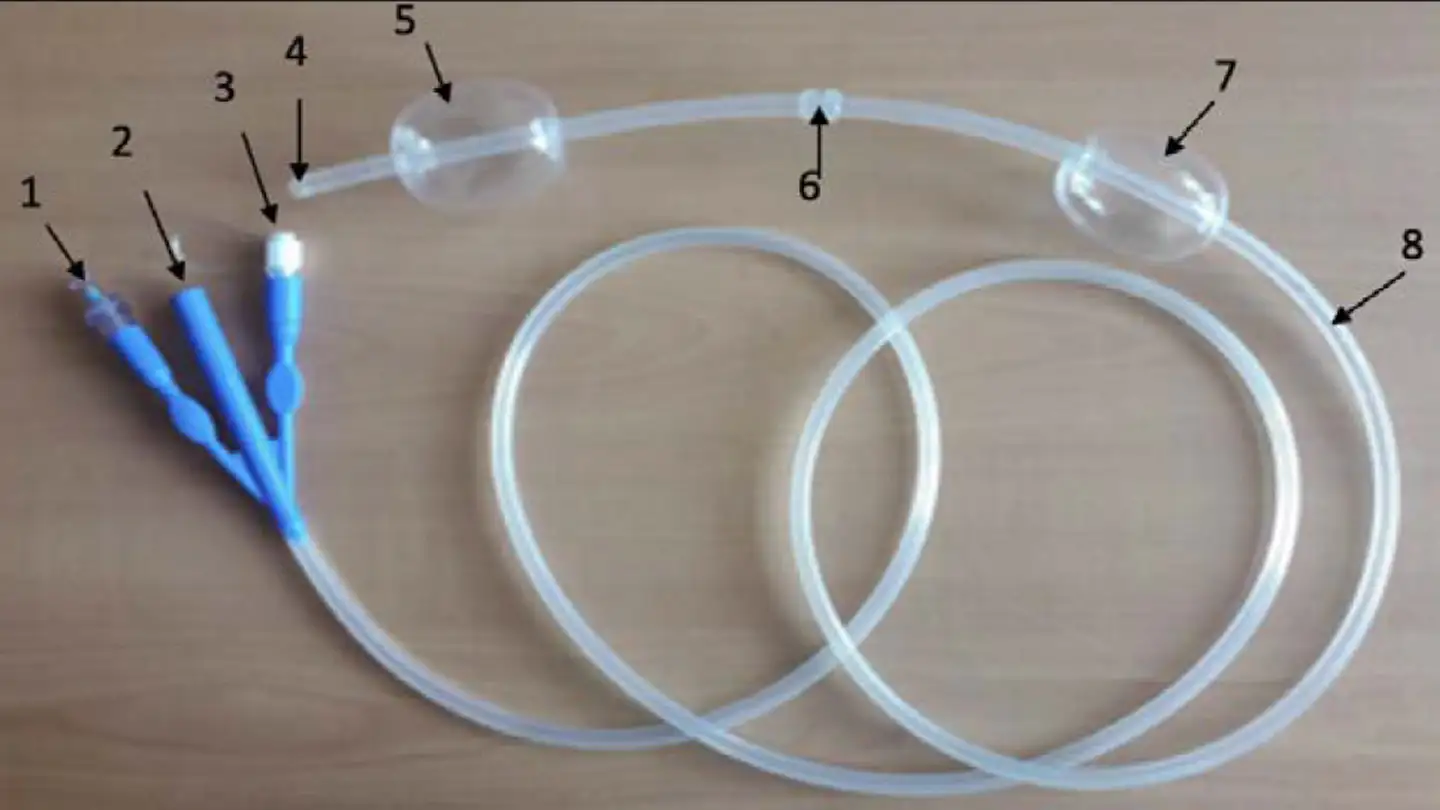 Применение специального назоинтестинального зонда в лечении больной острым панкреатитом