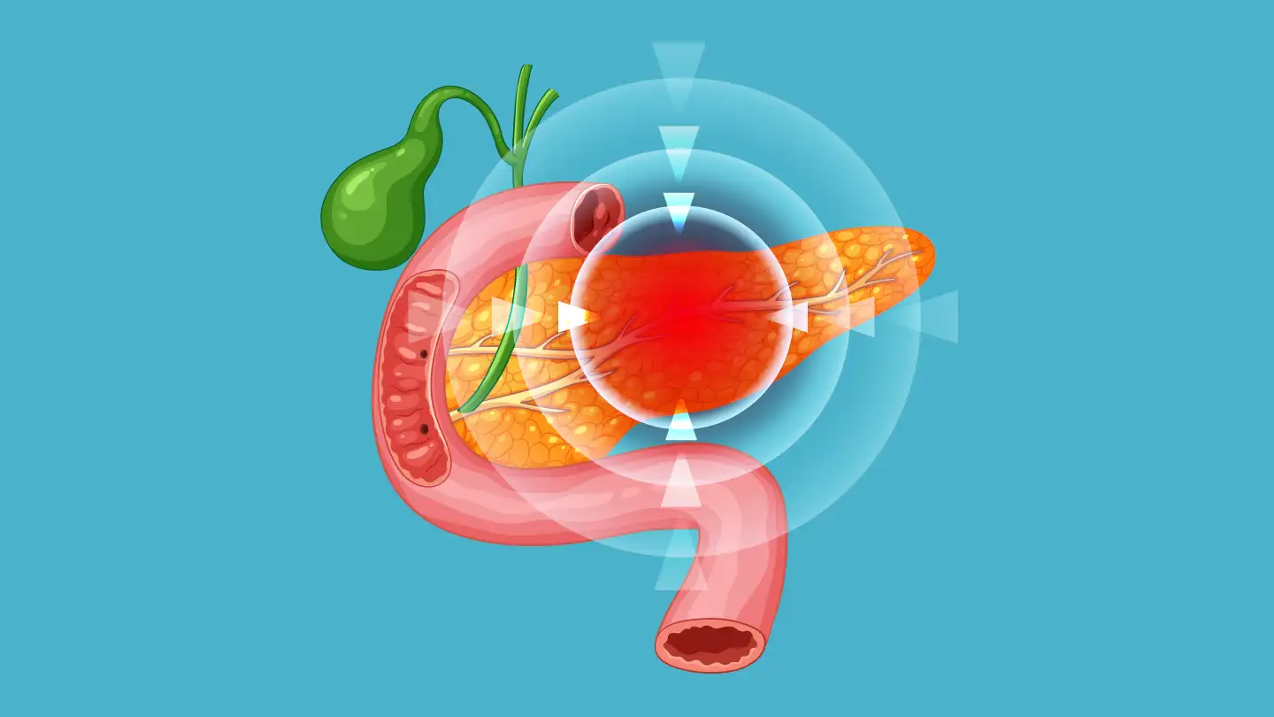 Профилактика инфекционных осложнений острого панкреатита