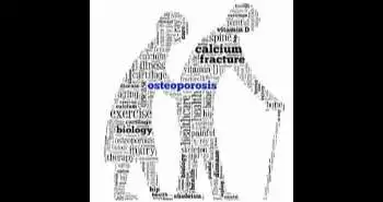 Impact of fat mass index, ageing bone, body fat percentage, and body mass index in the osteoporosis development