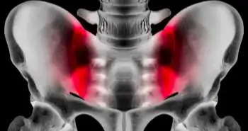 Surgical management of femoroacetabular impingement negatively impacts radiographic osteoarthritis condition