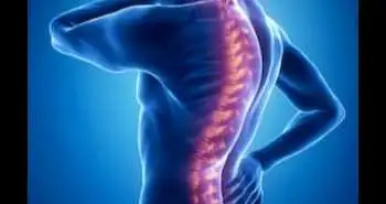 Epiduroscopic Adhesiolysis: A reliable treatment for failed Back Surgery Syndrome