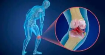 MRI for the evaluation of knee pain