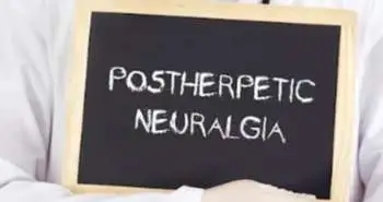 Efficacy of low dose gabapentin in acute herpes zoster for preventing postherpetic neuralgia: a prospective controlled study