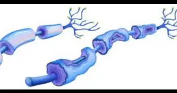 Local injection of Methylcobalamin combined with Lidocaine for acute herpetic neuralgia