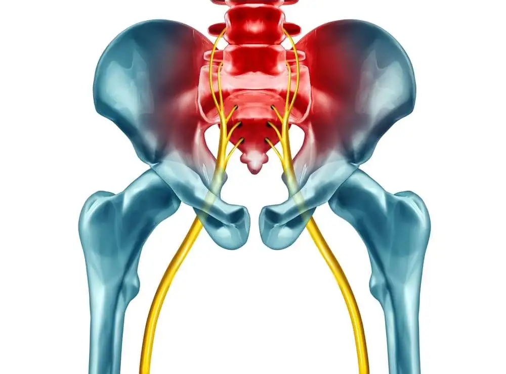 A study conducted to evaluate the efficacy and safety of NSAIDs for sciatica