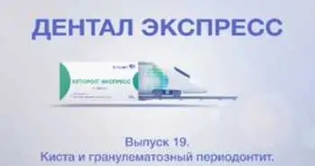 Выпуск 19. Киста и гранулематозный периодонтит