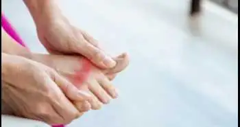 Canakinumab improves joint tenderness, swelling and reduces pain relief in patients experiencing a gout flare