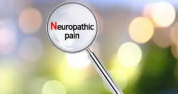 Management and risk factors linked with chronic neuropathic pain after hand burns