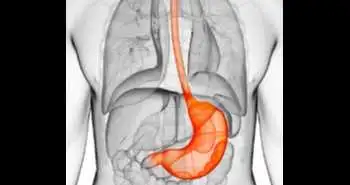 Study evaluates amoxicillin plus berberine vs tetracycline plus furazolidone in quadruple therapy for H.pylori rescue treatment