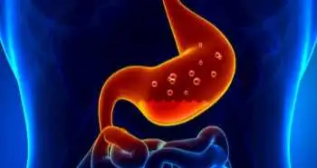 GERD drug trial discontinued due to no significant improvement in heartburn severity