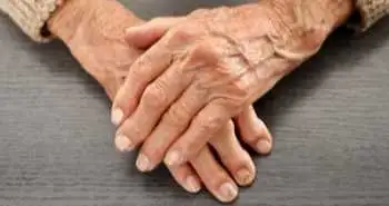 Study evaluates safety and efficacy of fostamatinib to treat rheumatoid arthritis