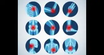 Study evaluates cannabis use and its effect on pain in rheumatologic diseases