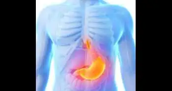 Rabeprazole as an effective treatment therapy for reducing gastric damage associated with low dose aspirin