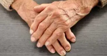 Study elucidates lipid level changes in case of different rheumatoid arthritis therapies