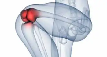 Subcutaneous Tanezumab can help relieve pain in Hip or Knee Osteoarthritis