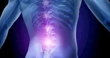 Study found transforaminal epidural steroid injection to be effective for radicular pain