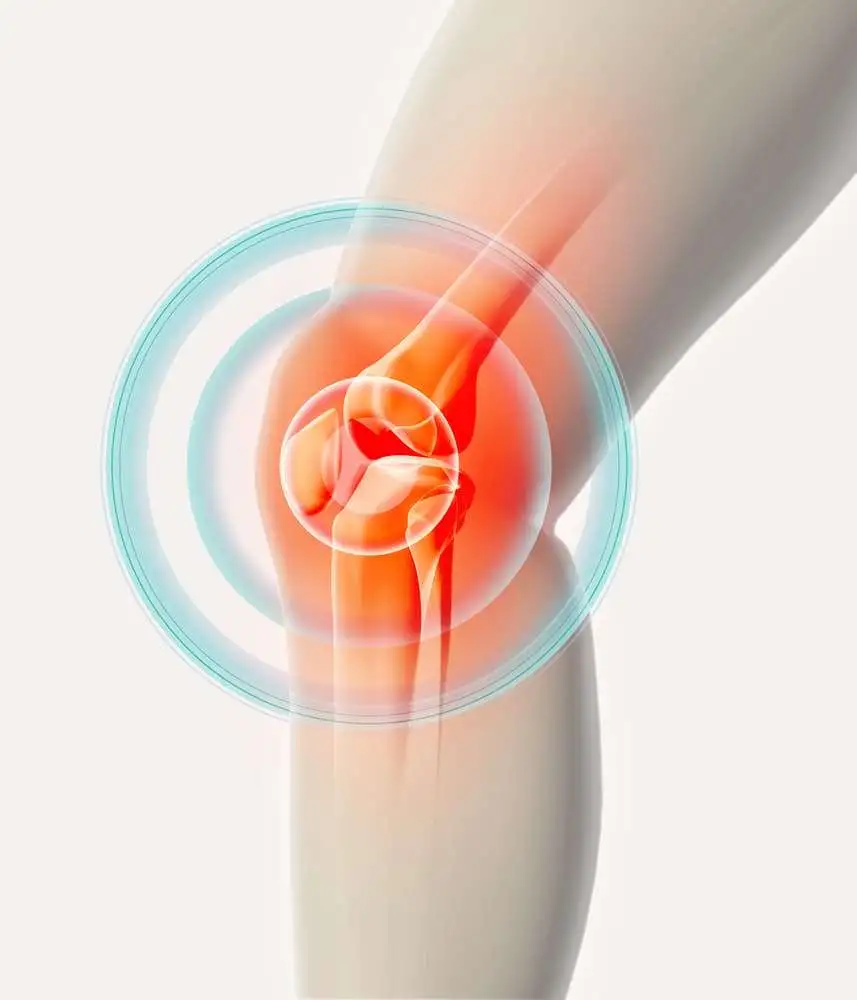 Effectiveness of intra-articular injections of sodium bicarbonate and calcium gluconate in the treatment of osteoarthritis of the knee: a randomized double-blind clinical trial.