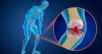 Difference between Genicular Nerve blockade via classical anatomical targets versus revised targets in knee osteoarthritis