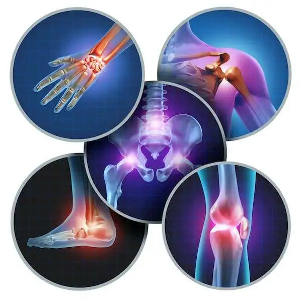 Federal clinical recommendations on osteoarthritis diagnostics and therapy 2013