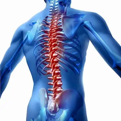 Spondylitis