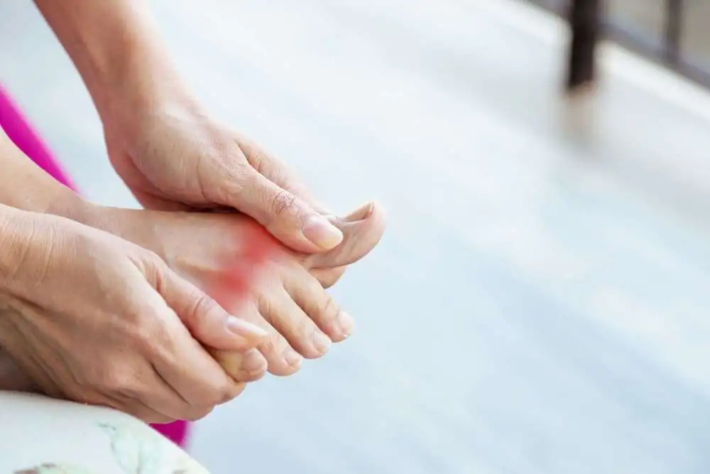 Treatment of tophaceous gout: When medication is not enough