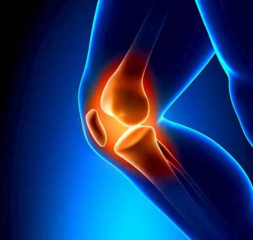 Osteoarthritis