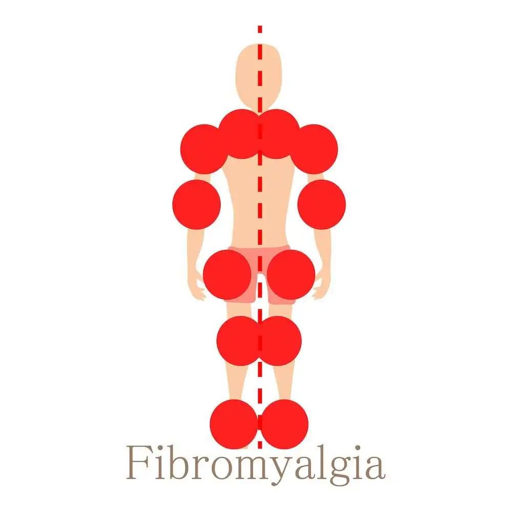 Self-reported nonrestorative sleep in fibromyalgia – relationship to impairments of body functions, personal function factors, and quality of life