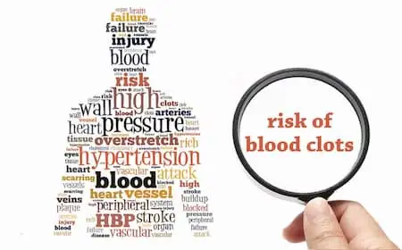 venous thromboembolism