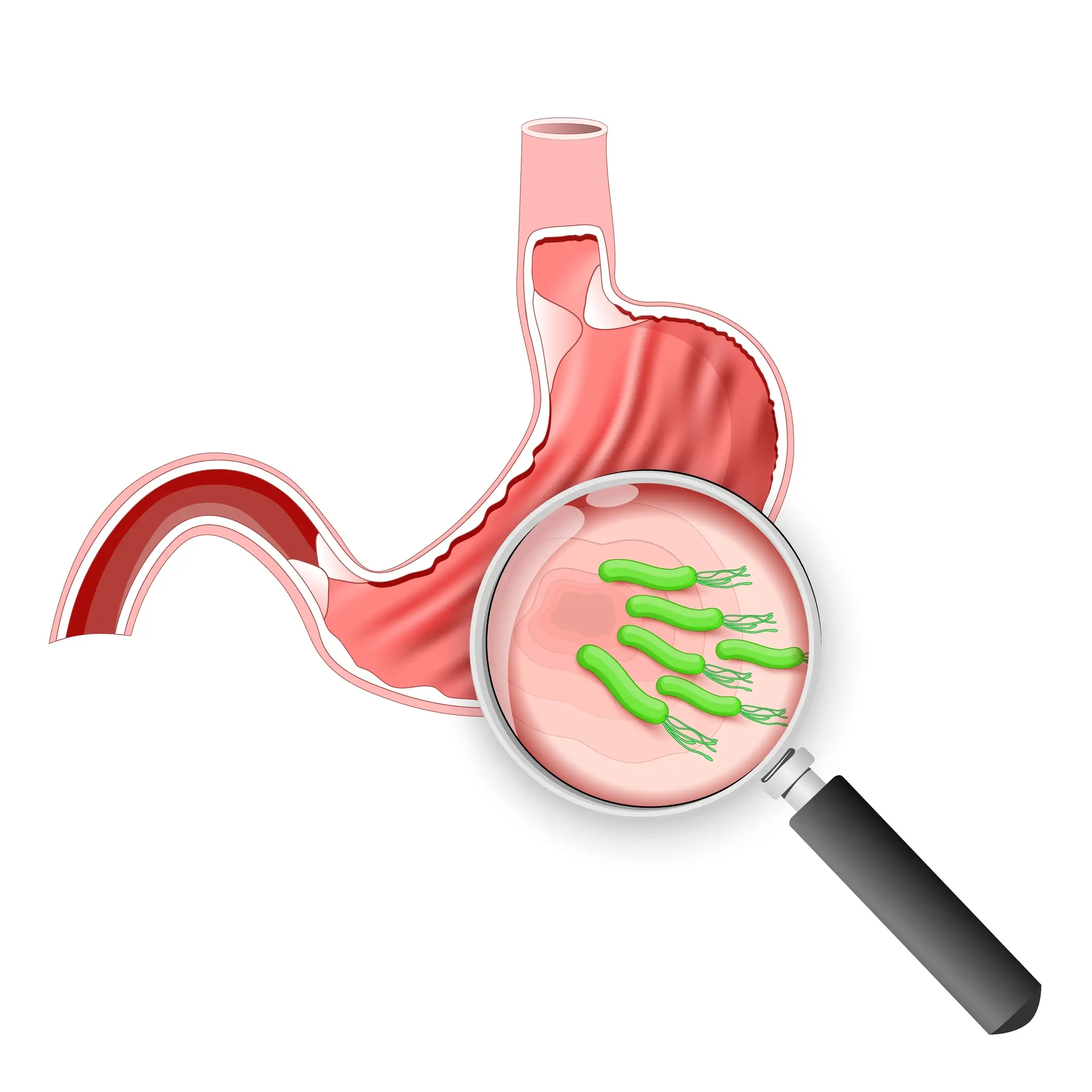 dual regimen for h. pylori