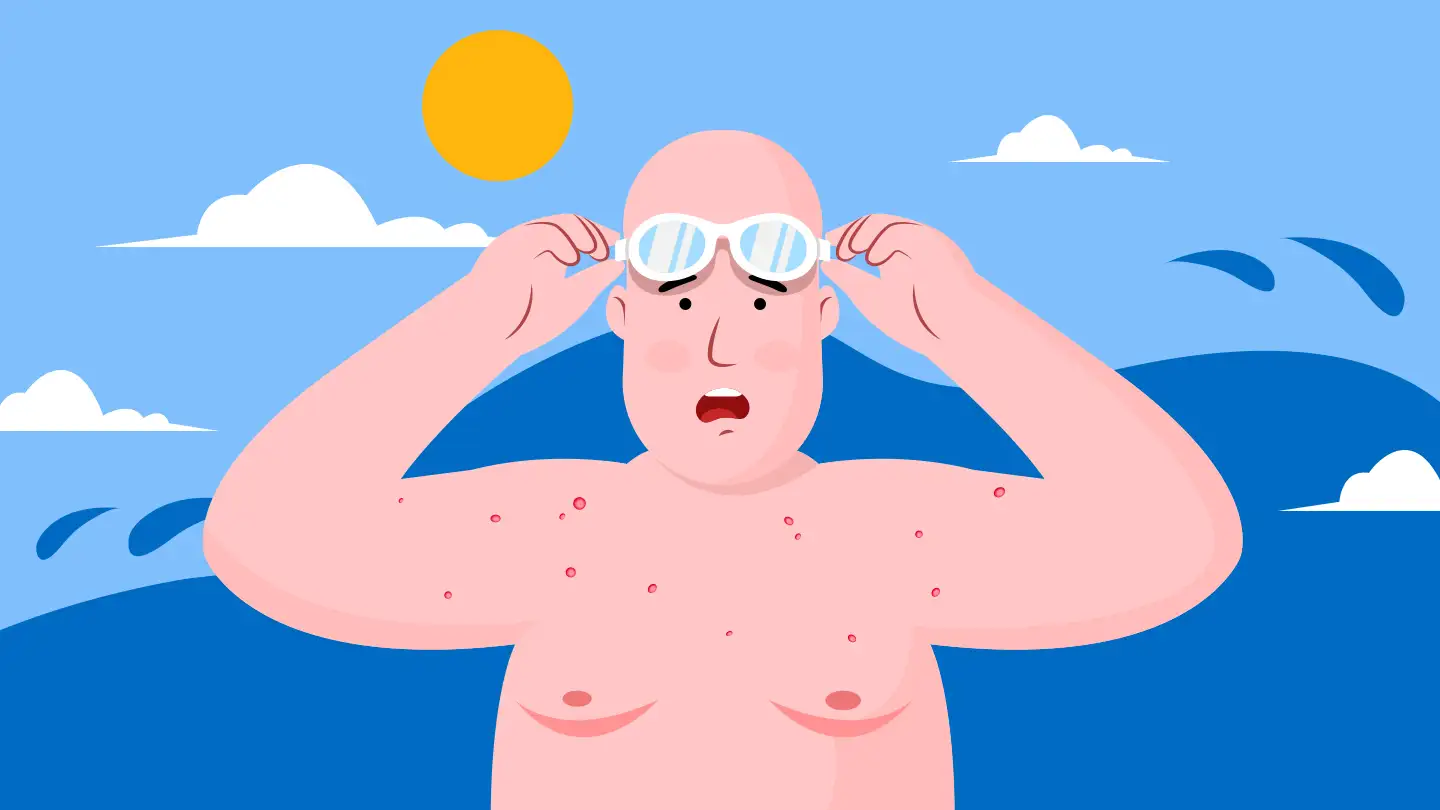 почему появилась сыпь на коже после купания в горной реке?