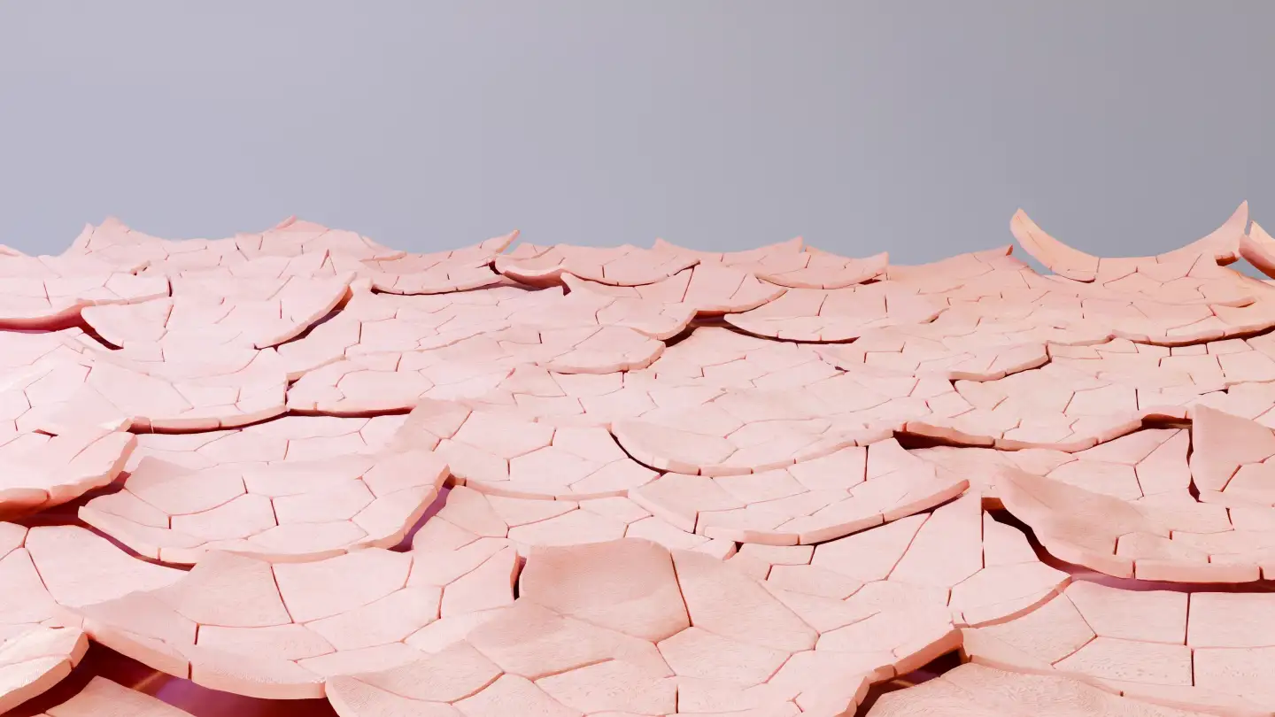 Тамразова Ксероз кожи