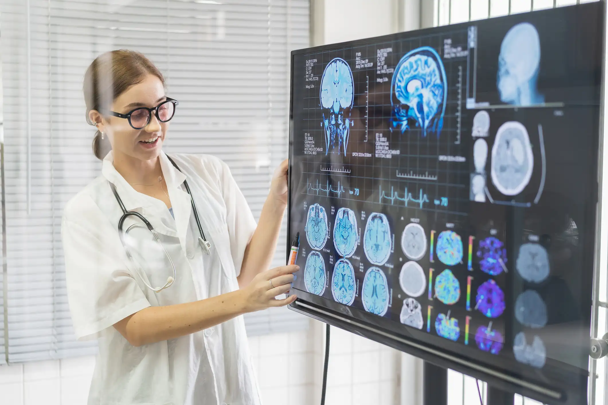 Клеточные механизмы атеросклероза, приводящего к инсульту