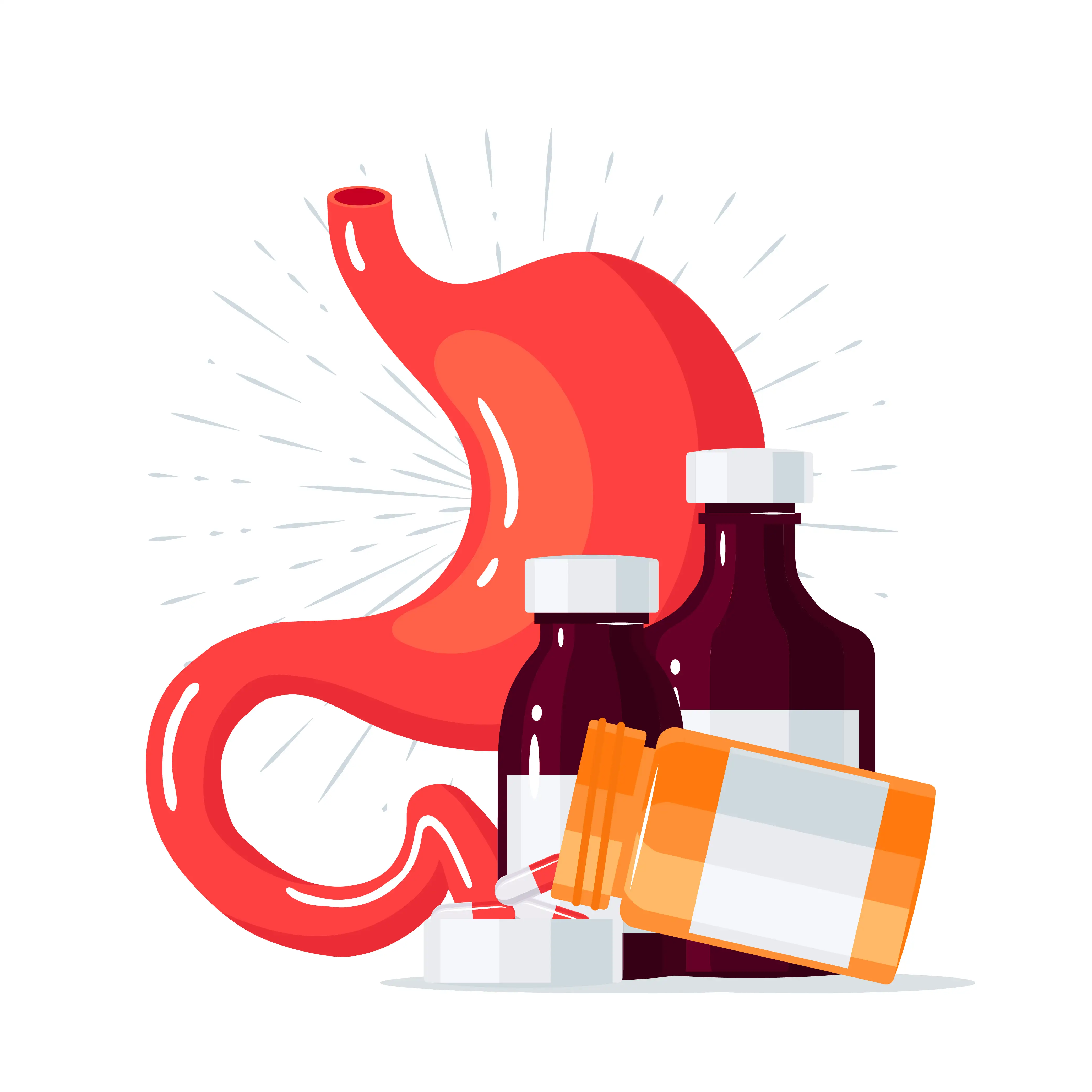 рефлюксный эзофагит