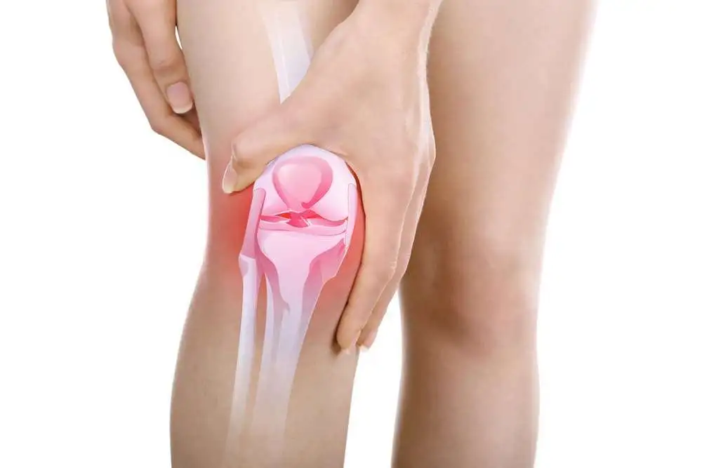 The comparison of anterior knee pain in severe and non-severe arthritis of the lateral facet of the patella following a mobile bearing unicompartmental knee arthroplasty