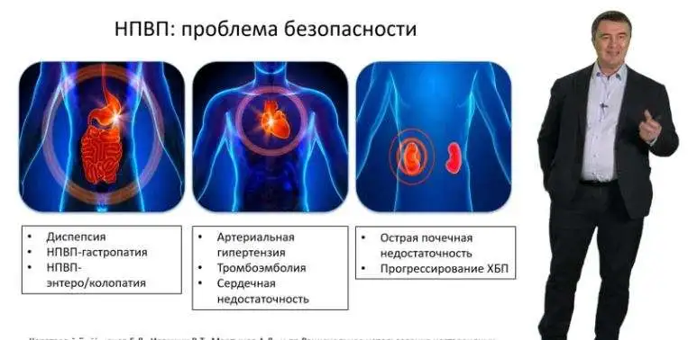 Новые данные о безопасности длительного использования НПВП при ревматических заболеваниях