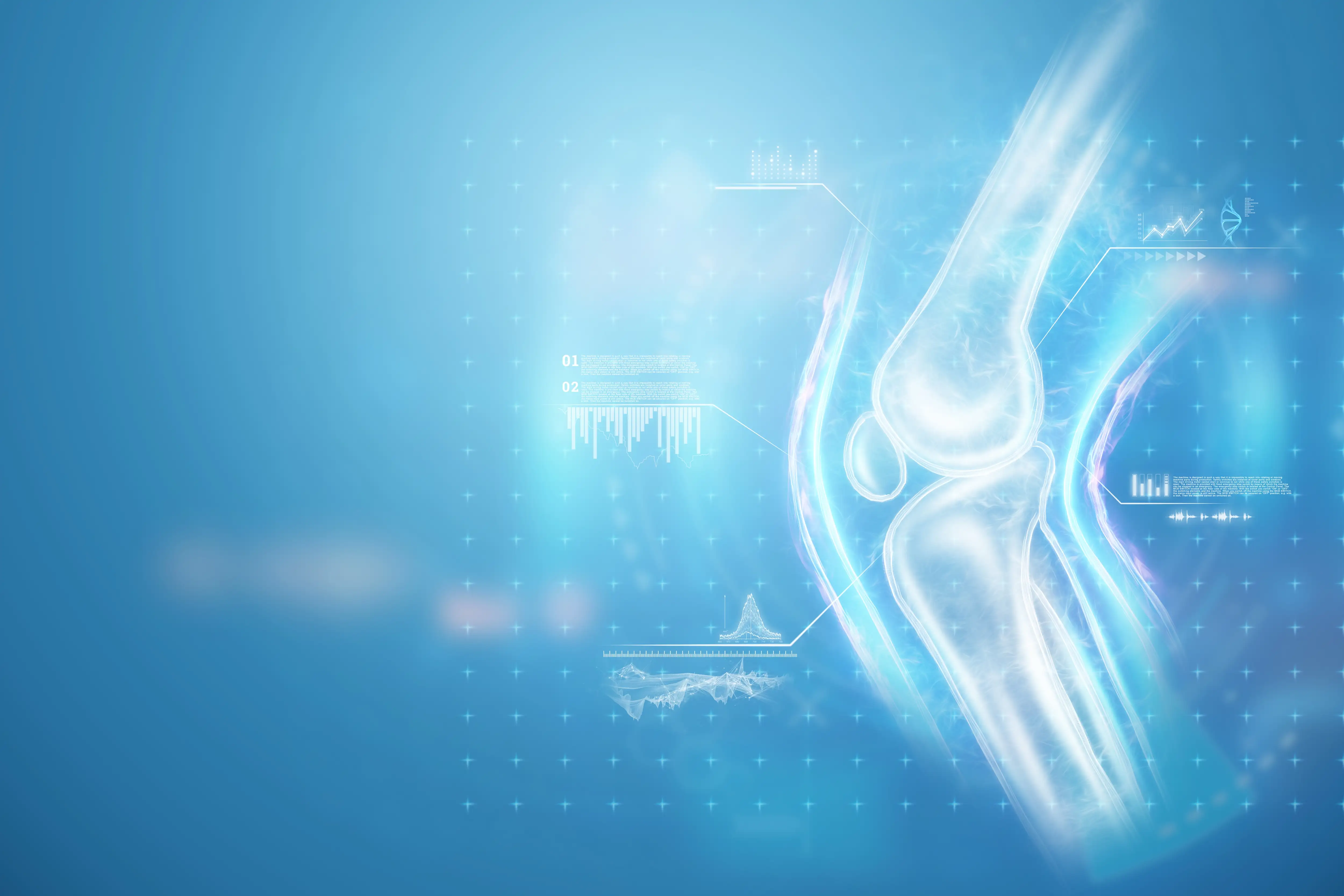 остеоартроз коленного сустава