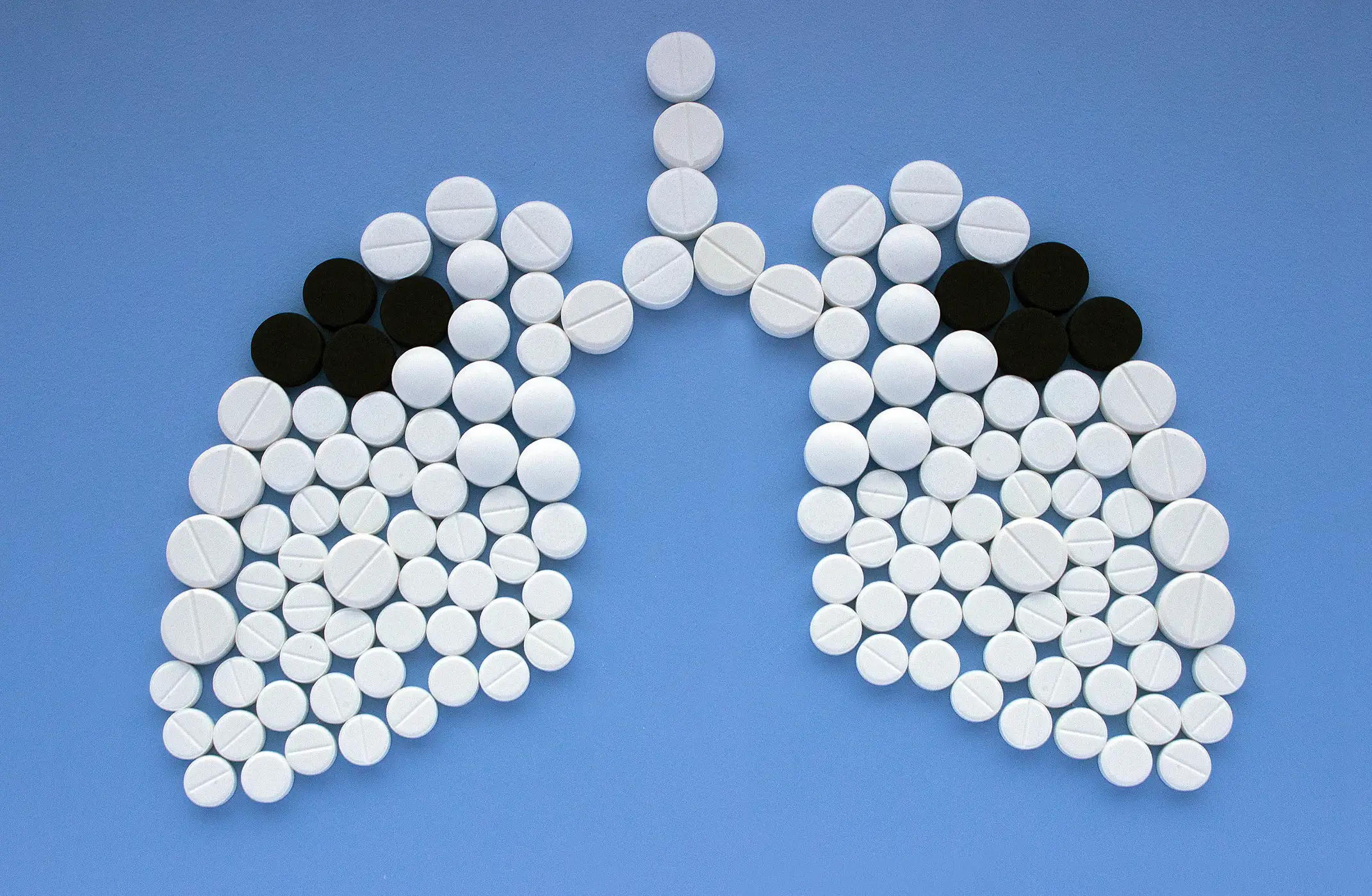 Новые схемы терапии туберкулёза с лекарственной устойчивостью подтвердили эффективность