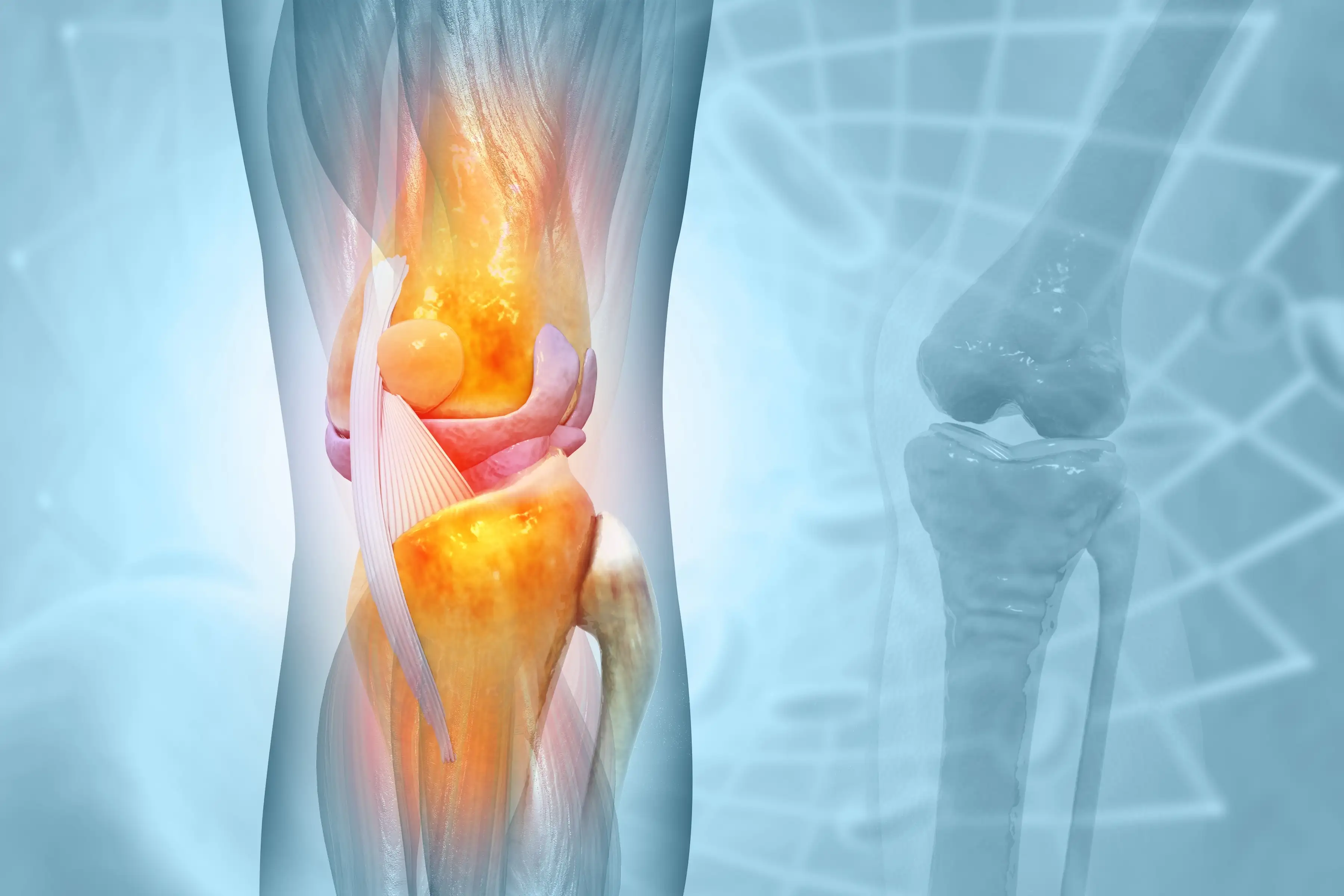 Patellofemoral pain