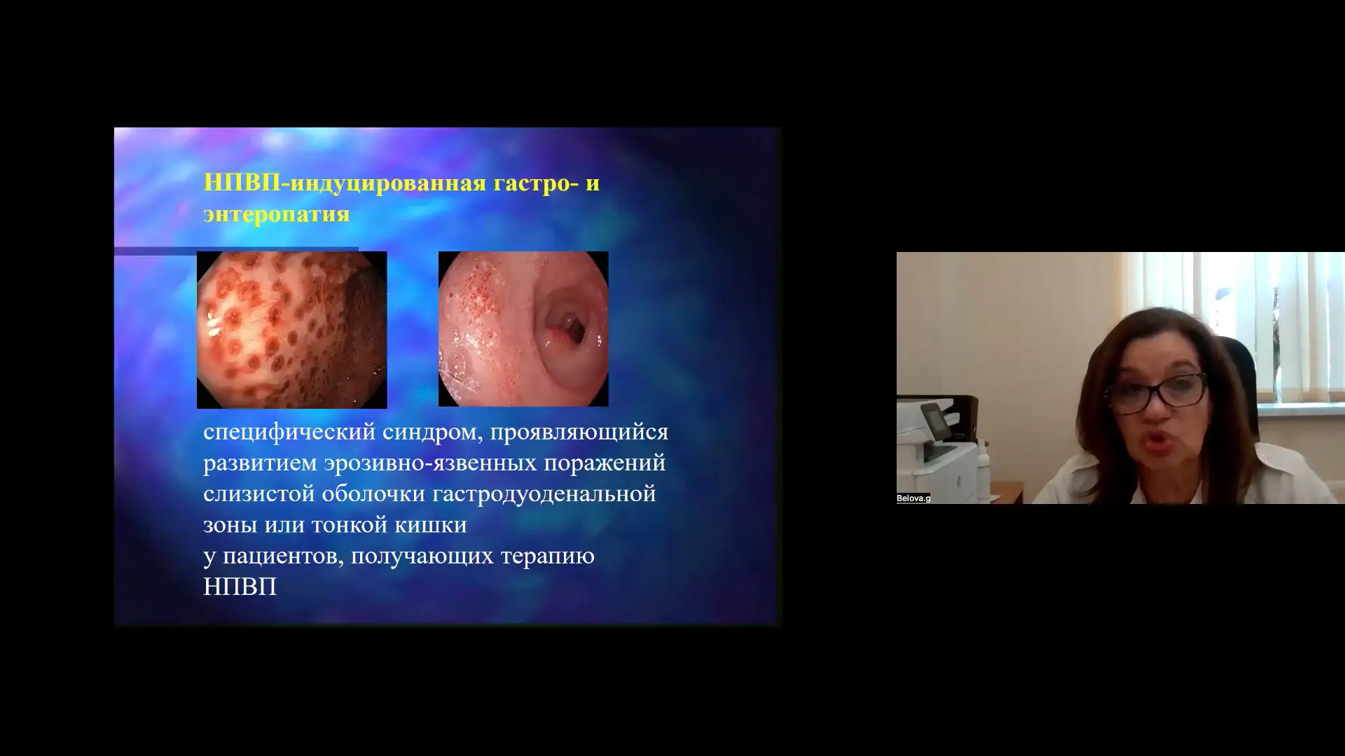 Белова ГВ НПВП-индуцированная гастро- и энтеропатия Клинические случаи из практики эндоскопистов