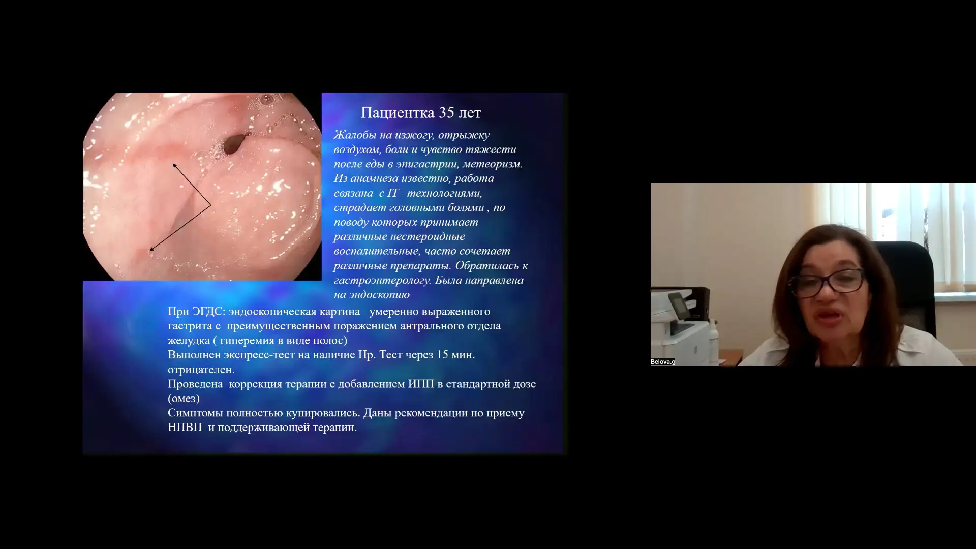 Белова ГВ Клинический случай из практики эндоскопистов Пациентка 35 лет