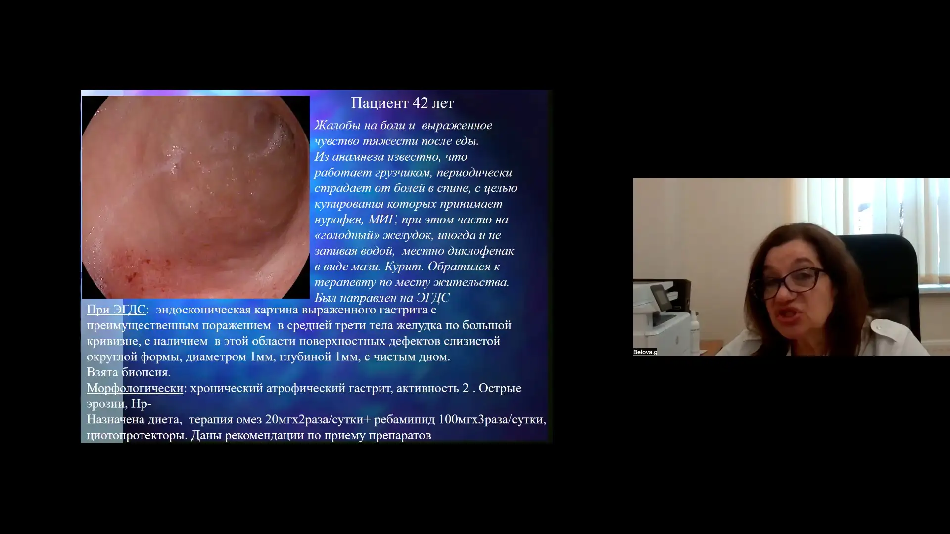 Белова ГВ Клинический случай пациента 42 года боли и выраженное чувство тяжести после еды На приеме у эндоскописта